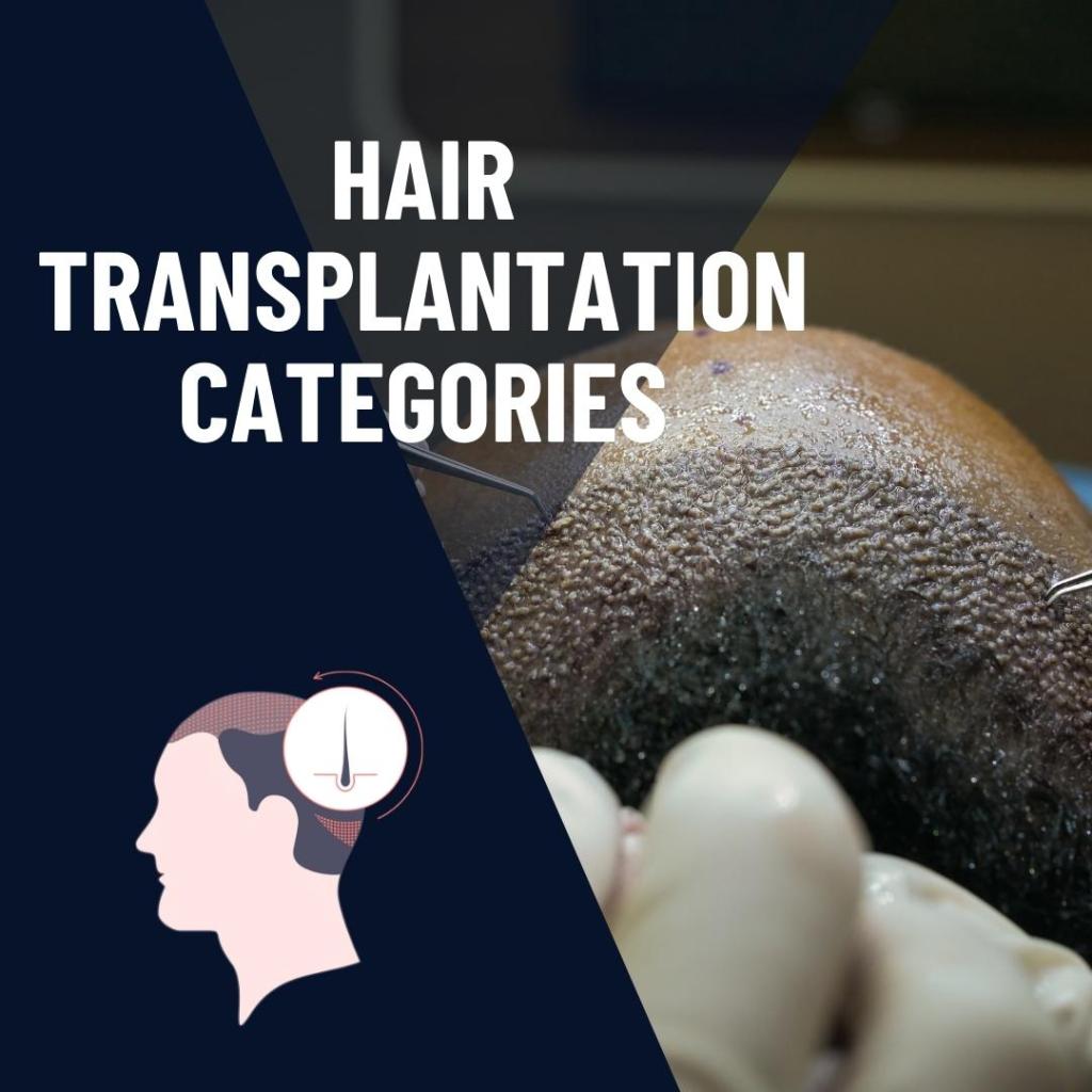 Hair Transplantation Categories